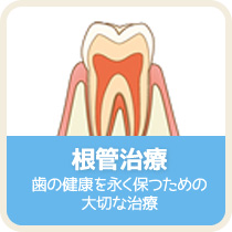 根管治療：歯の健康を永く保つための大切な治療