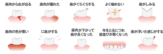 歯周病チェック